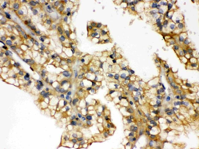 Aquaporin 2 Antibody in Immunohistochemistry (Paraffin) (IHC (P))