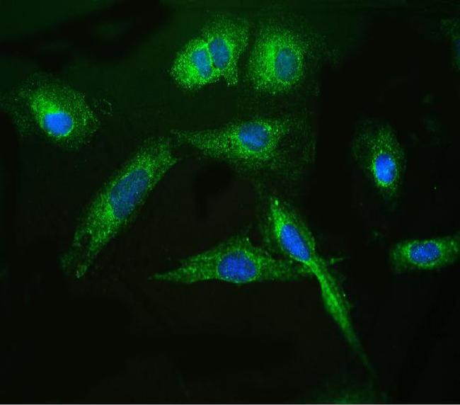 ARSA Antibody in Immunocytochemistry (ICC/IF)