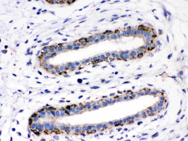 ASPH Antibody in Immunohistochemistry (Paraffin) (IHC (P))