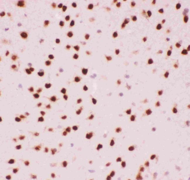 ATF2 Antibody in Immunohistochemistry (Paraffin) (IHC (P))