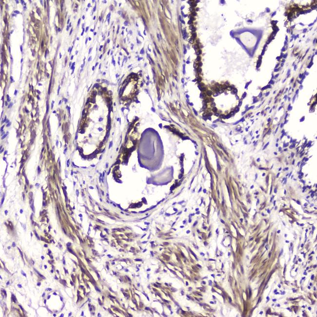 ATF4 Antibody in Immunohistochemistry (Paraffin) (IHC (P))