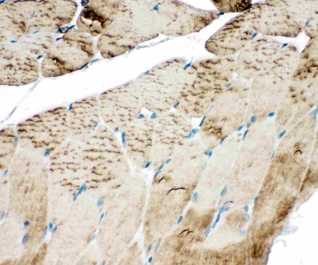 SERCA1 ATPase Antibody in Immunohistochemistry (Paraffin) (IHC (P))