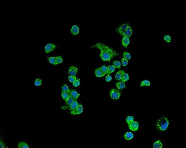 ATP5H Antibody in Immunocytochemistry (ICC/IF)