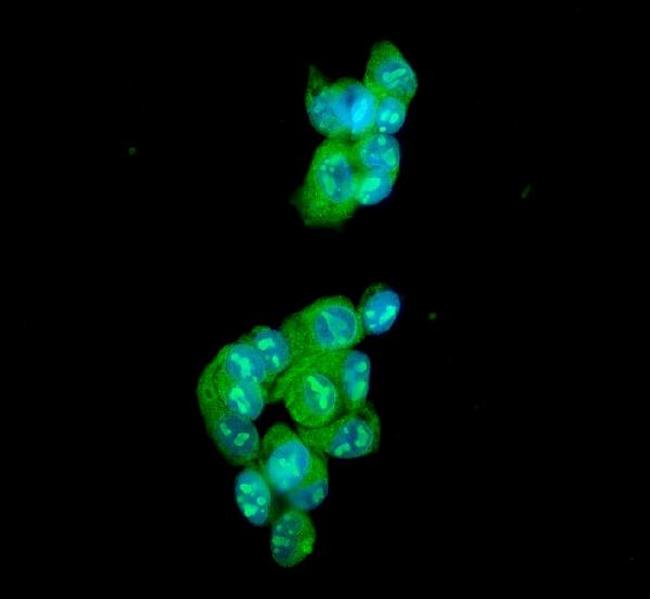 Ataxin 1 Antibody in Immunocytochemistry (ICC/IF)