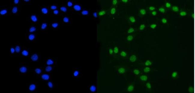 Ataxin 3 Antibody in Immunocytochemistry (ICC/IF)