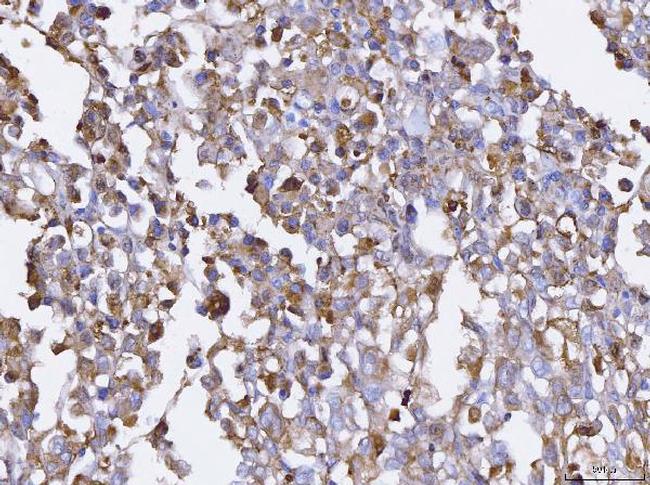 BCAT1 Antibody in Immunohistochemistry (Paraffin) (IHC (P))