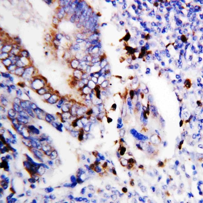 Bcl-XS Antibody in Immunohistochemistry (Paraffin) (IHC (P))