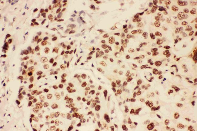 BRCA1 Antibody in Immunohistochemistry (Paraffin) (IHC (P))