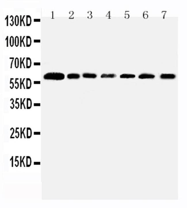 PRMT4 Antibody in Western Blot (WB)