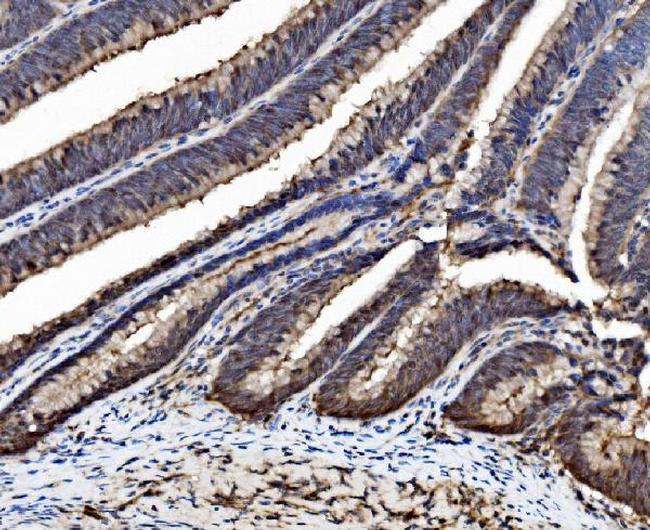 Caspase 6 p18 Antibody in Immunohistochemistry (Paraffin) (IHC (P))