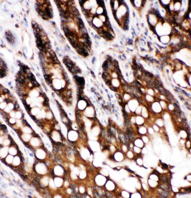 Caspase 6 p18 Antibody in Immunohistochemistry (Paraffin) (IHC (P))