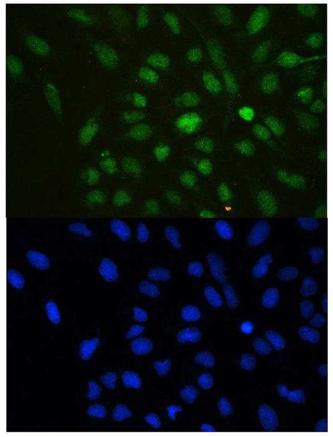 HP1 gamma Antibody in Immunocytochemistry (ICC/IF)