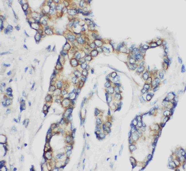 CD1d Antibody in Immunohistochemistry (Paraffin) (IHC (P))