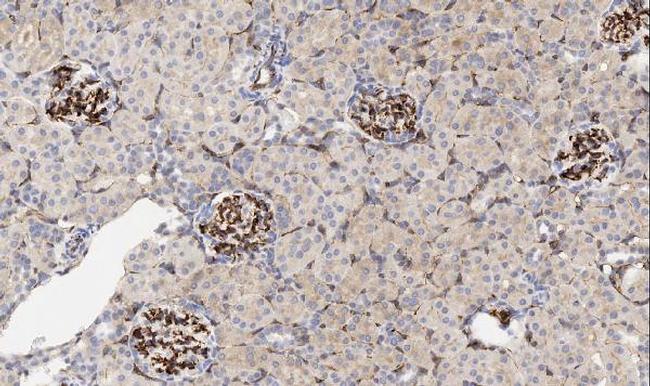 CD34 Antibody in Immunohistochemistry (Paraffin) (IHC (P))