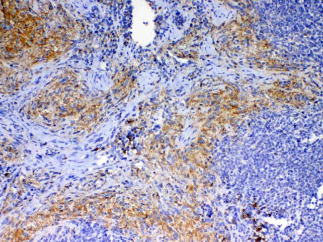 CD154 (CD40 Ligand) Antibody in Immunohistochemistry (Paraffin) (IHC (P))