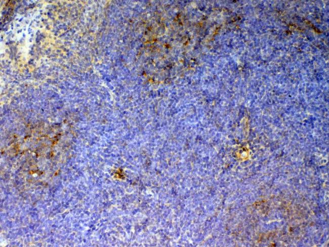 CD59 Antibody in Immunohistochemistry (Paraffin) (IHC (P))