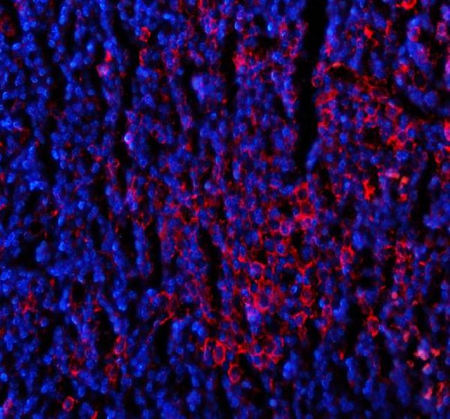 CD80 (B7-1) Antibody in Immunohistochemistry (Paraffin) (IHC (P))