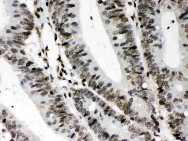 CIITA Antibody in Immunohistochemistry (Paraffin) (IHC (P))