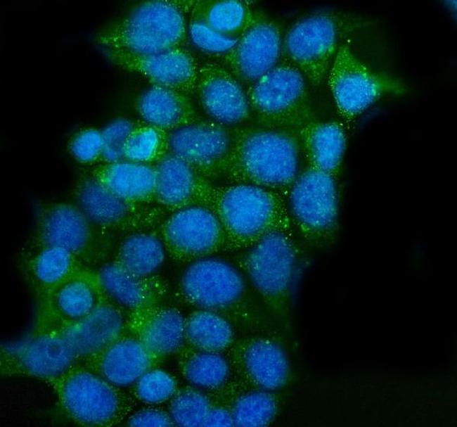 CLPP Antibody in Immunocytochemistry (ICC/IF)