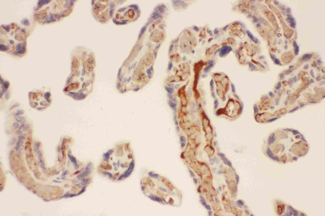 Mast Cell Chymase Antibody in Immunohistochemistry (Paraffin) (IHC (P))