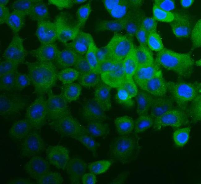 COL4A2 Antibody in Immunocytochemistry (ICC/IF)