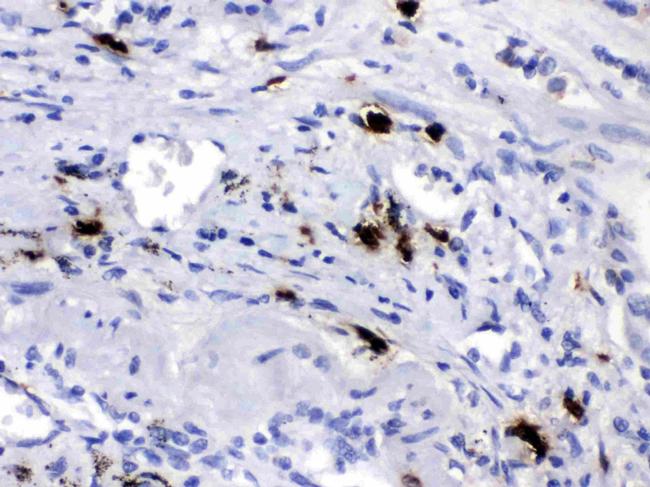 Carboxypeptidase B2 Antibody in Immunohistochemistry (Paraffin) (IHC (P))