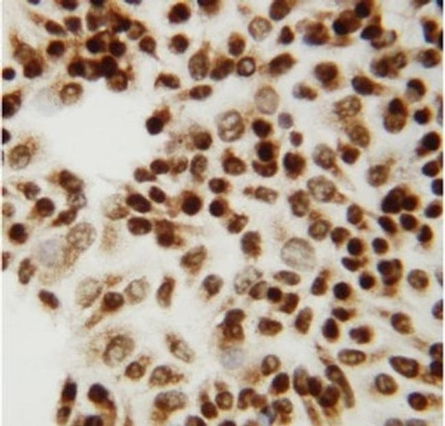 CtBP2 Antibody in Immunocytochemistry (ICC/IF)