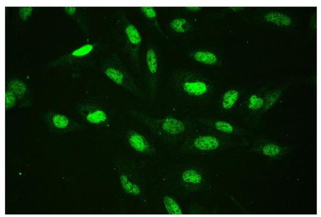 CtBP2 Antibody in Immunocytochemistry (ICC/IF)