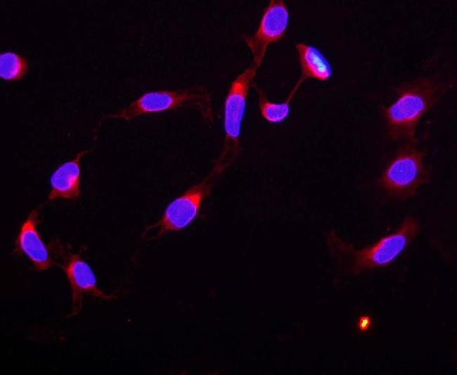 CTCF Antibody in Immunocytochemistry (ICC/IF)