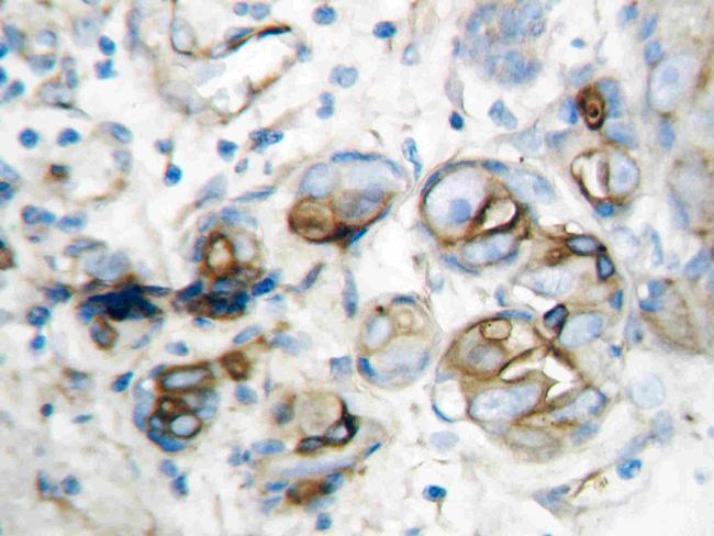 CXCL10 (IP-10) Antibody in Immunohistochemistry (Paraffin) (IHC (P))