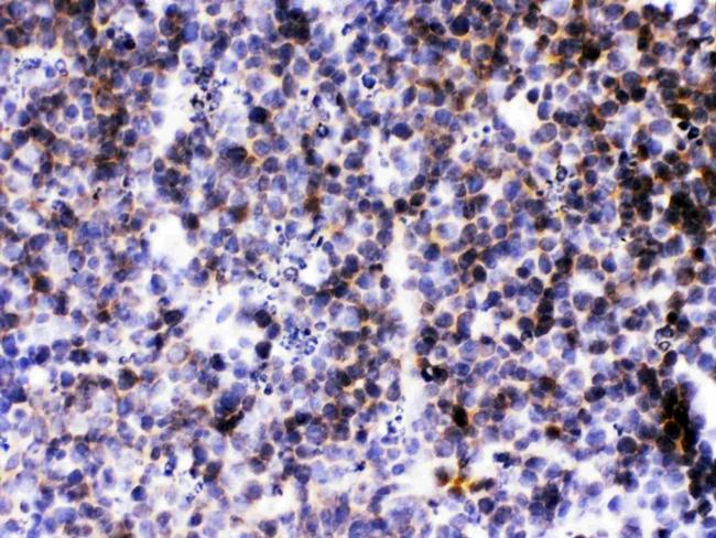 CXCL13 Antibody in Immunohistochemistry (Paraffin) (IHC (P))