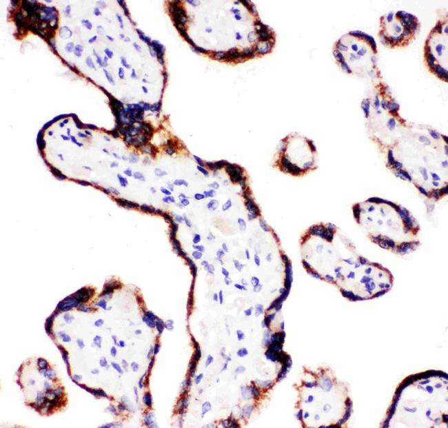 CYP11A1 Antibody in Immunohistochemistry (Paraffin) (IHC (P))