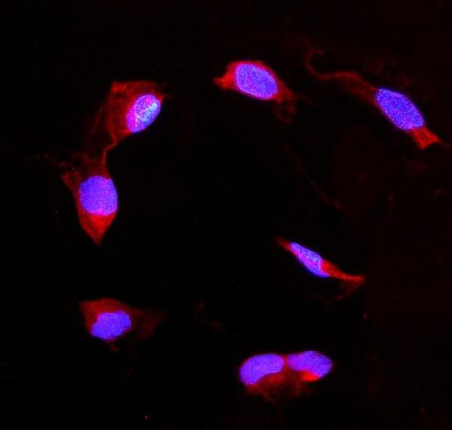 DDAH2 Antibody in Immunocytochemistry (ICC/IF)