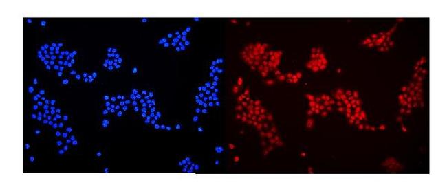 DDB1 Antibody in Immunocytochemistry (ICC/IF)