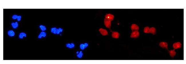 DDB2 Antibody in Immunocytochemistry (ICC/IF)