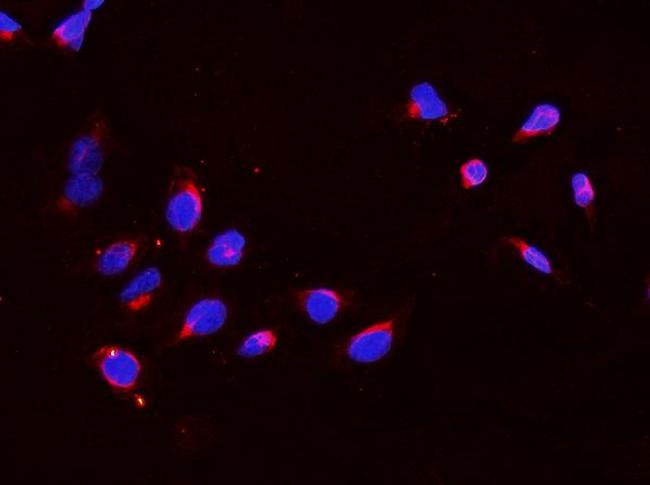 DDX4 Antibody in Immunocytochemistry (ICC/IF)