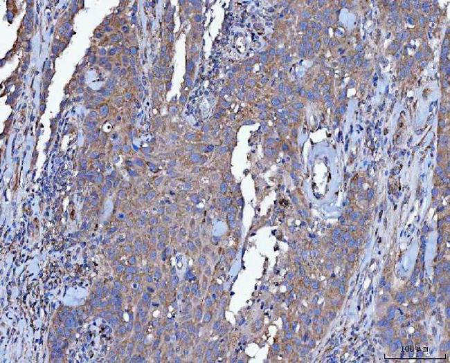 Dicer Antibody in Immunohistochemistry (Paraffin) (IHC (P))