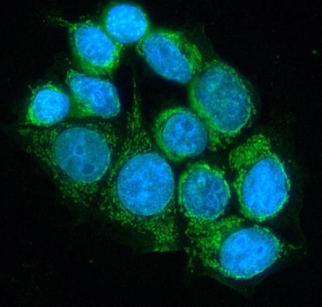 DLD Antibody in Immunocytochemistry (ICC/IF)