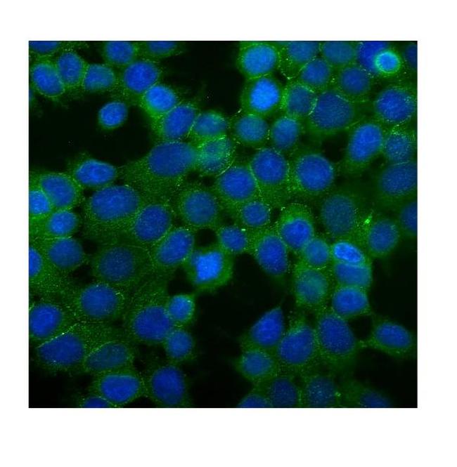 Desmoglein 2 (DSG2) Antibody in Immunocytochemistry (ICC/IF)