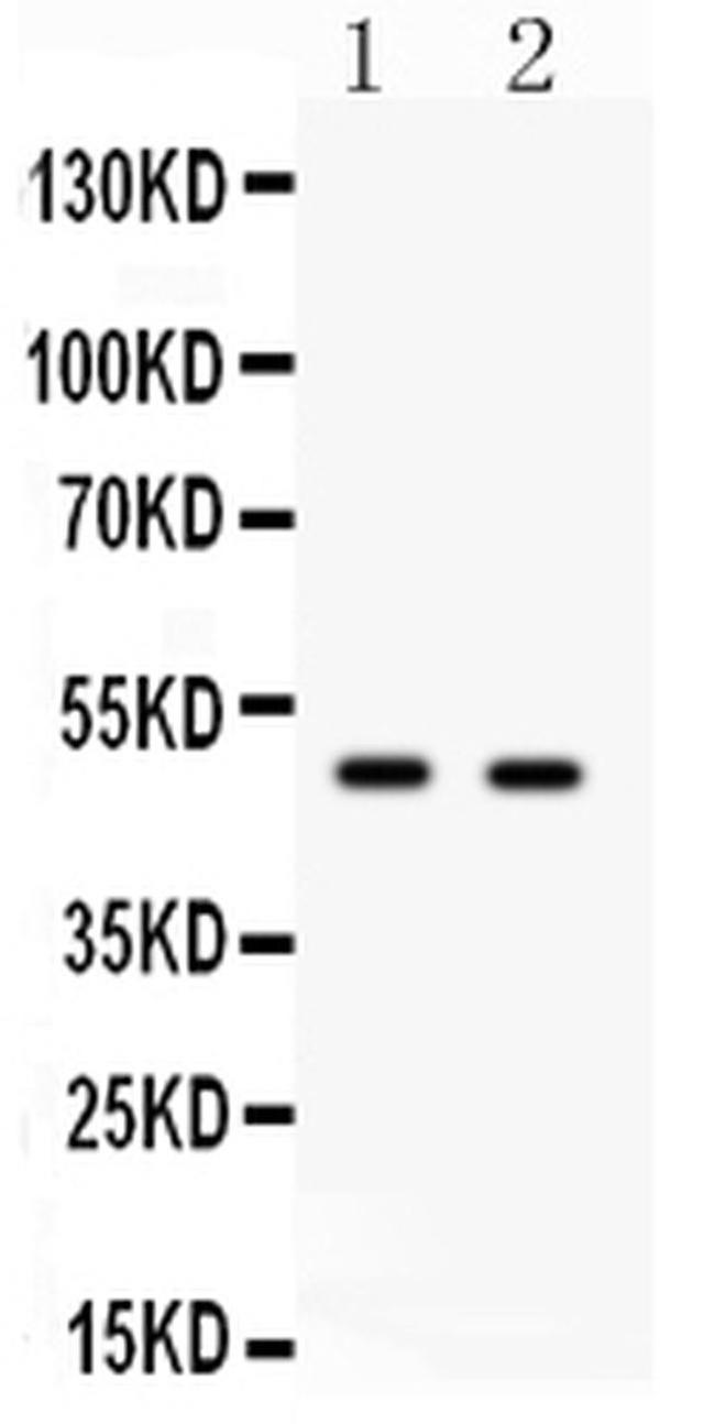 E2F3 Antibody in Western Blot (WB)