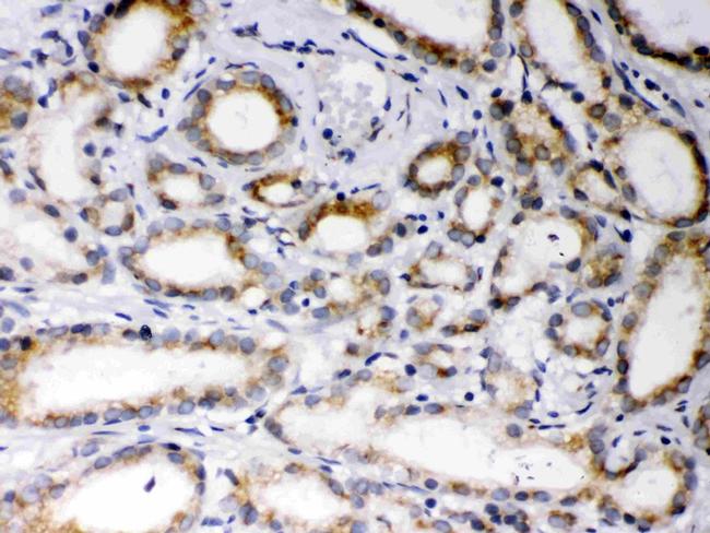 EBAG9 Antibody in Immunohistochemistry (Paraffin) (IHC (P))