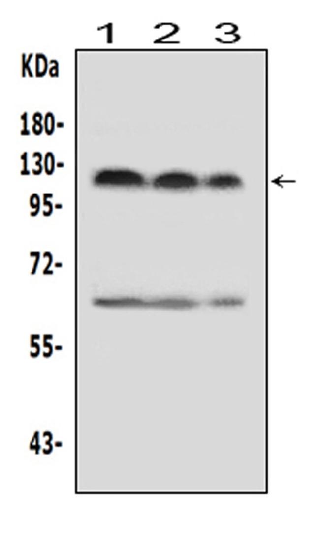 HIF-2 alpha Antibody in Western Blot (WB)