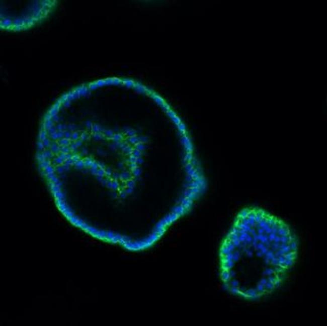 EpCAM (CD326) Antibody in Immunohistochemistry (Paraffin) (IHC (P))