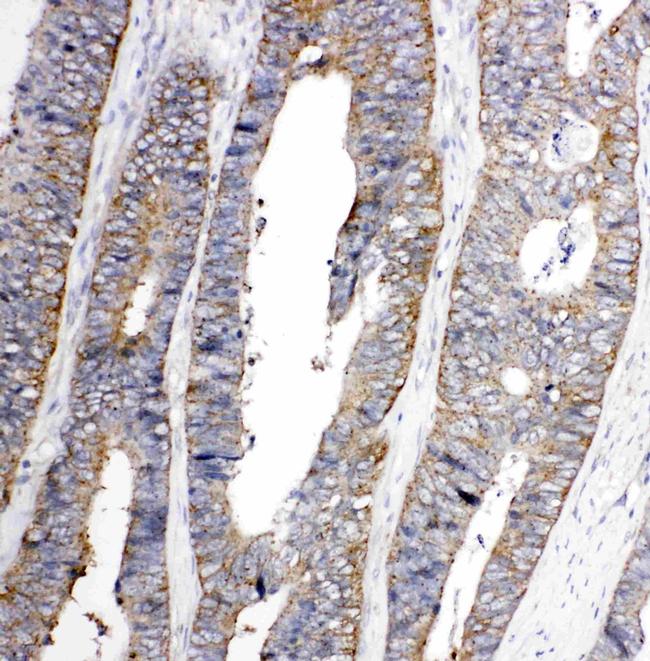 EphA1 Antibody in Immunohistochemistry (Paraffin) (IHC (P))