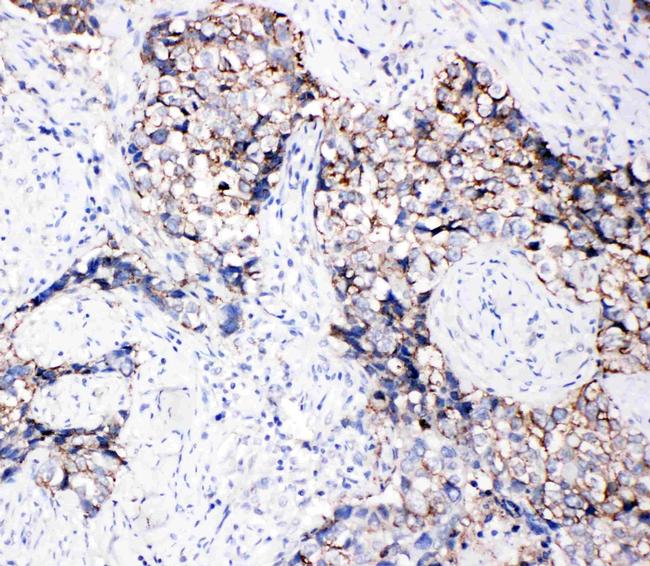 EphB3 Antibody in Immunohistochemistry (Paraffin) (IHC (P))