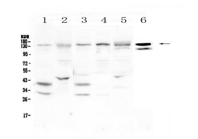 EPS15 Antibody in Western Blot (WB)