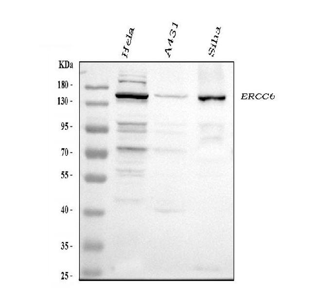 CSB Antibody in Western Blot (WB)