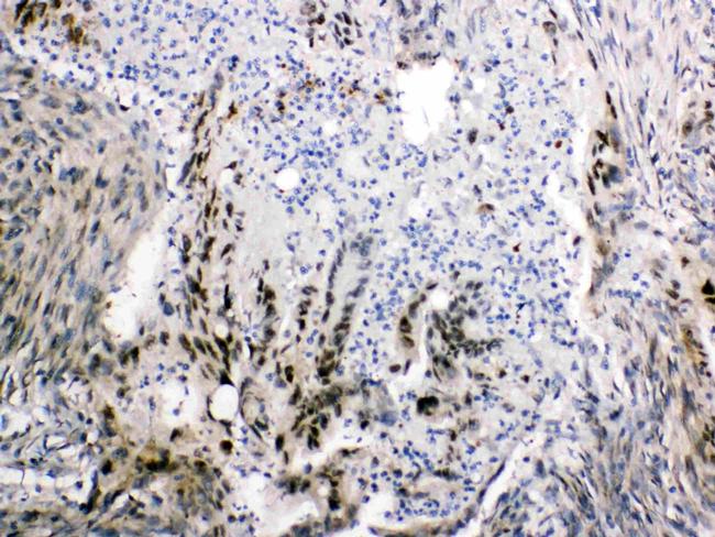 FABP2 Antibody in Immunohistochemistry (Paraffin) (IHC (P))