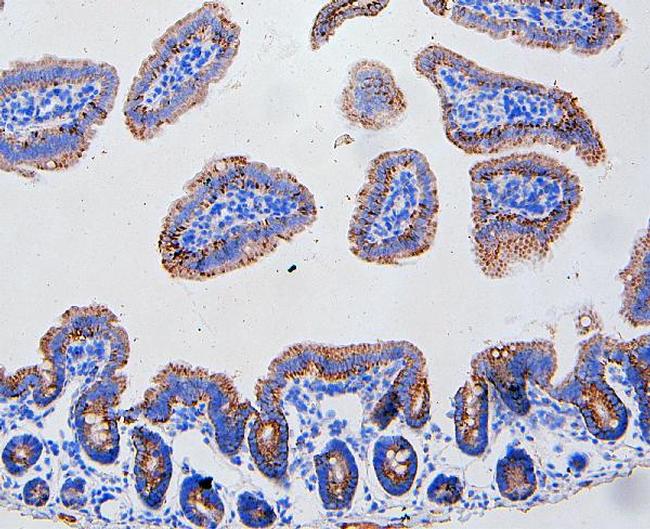 FAS (CD95) Antibody in Immunohistochemistry (Paraffin) (IHC (P))