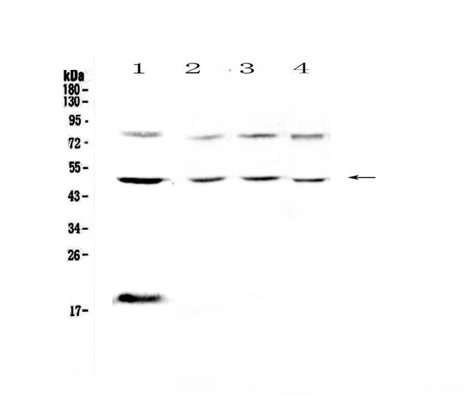 CD64 Antibody in Western Blot (WB)